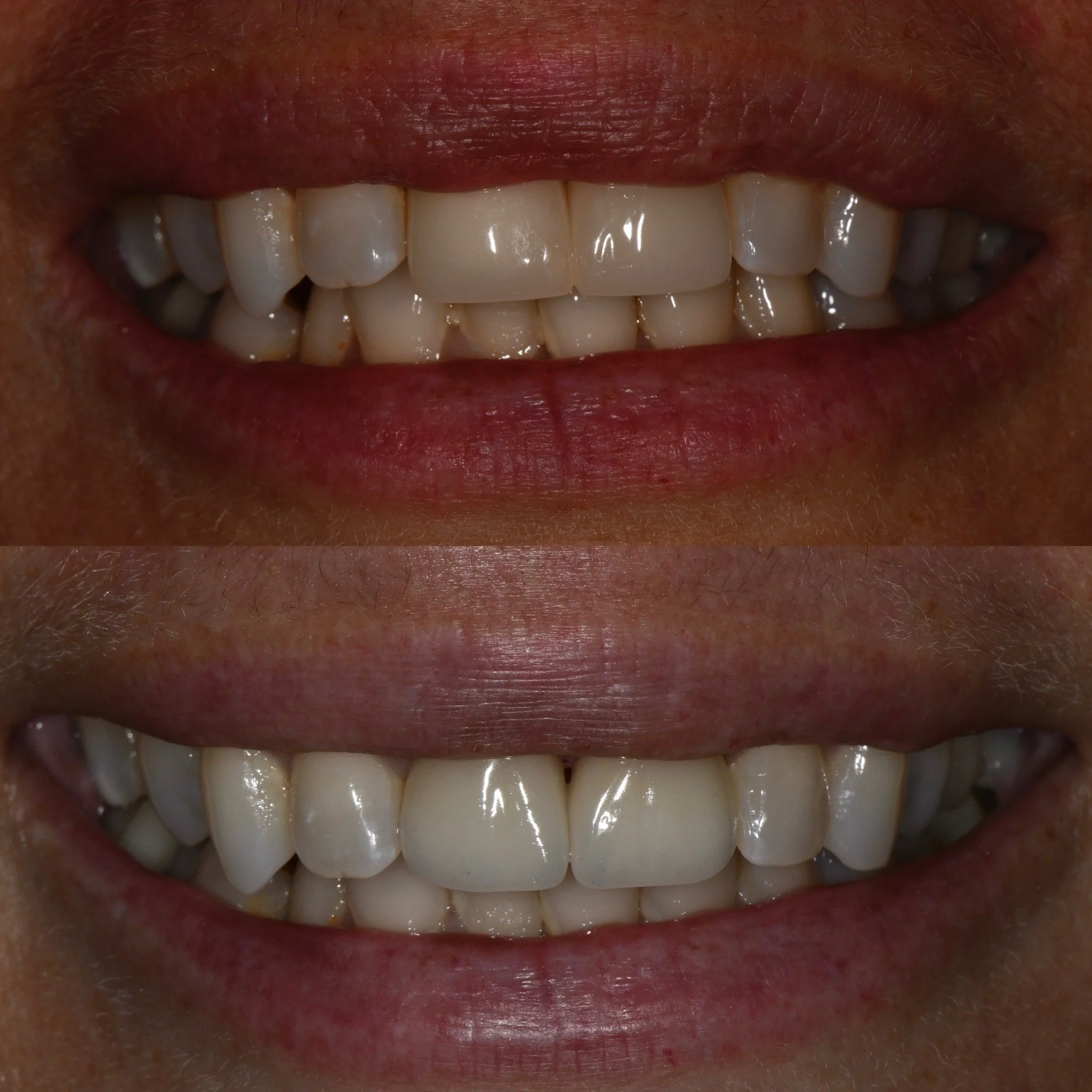 Gallery | Transform Your Smile Today — Greatest Smile Dentistry